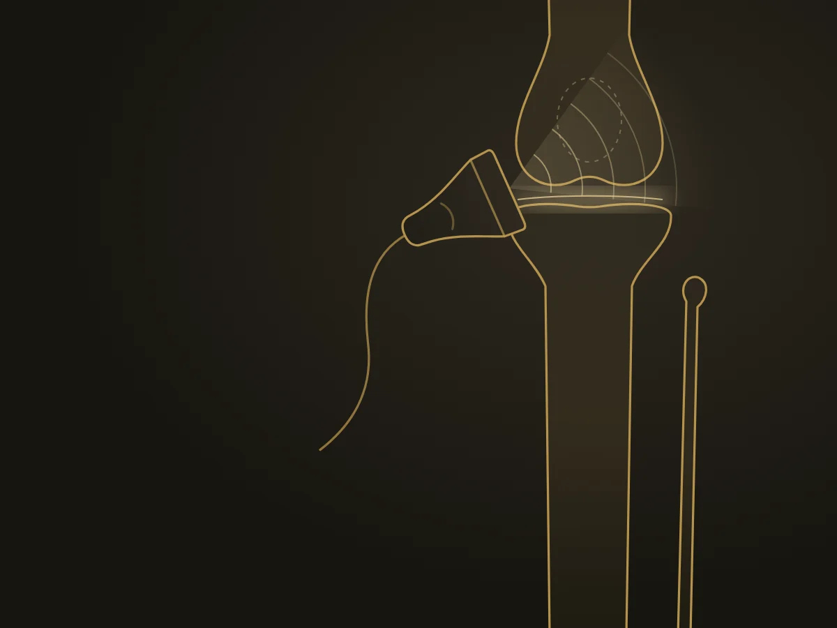 Ilustração de uma articulação do joelho avaliada por ultrassom